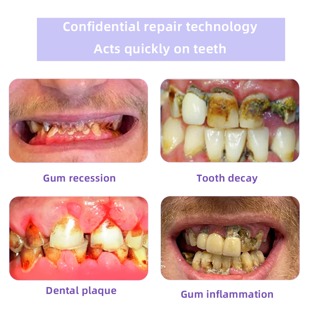Oyikeyยฎ ๐Tooth Restoration Mineral Powder (Whitening, Restoring Tooth Health)