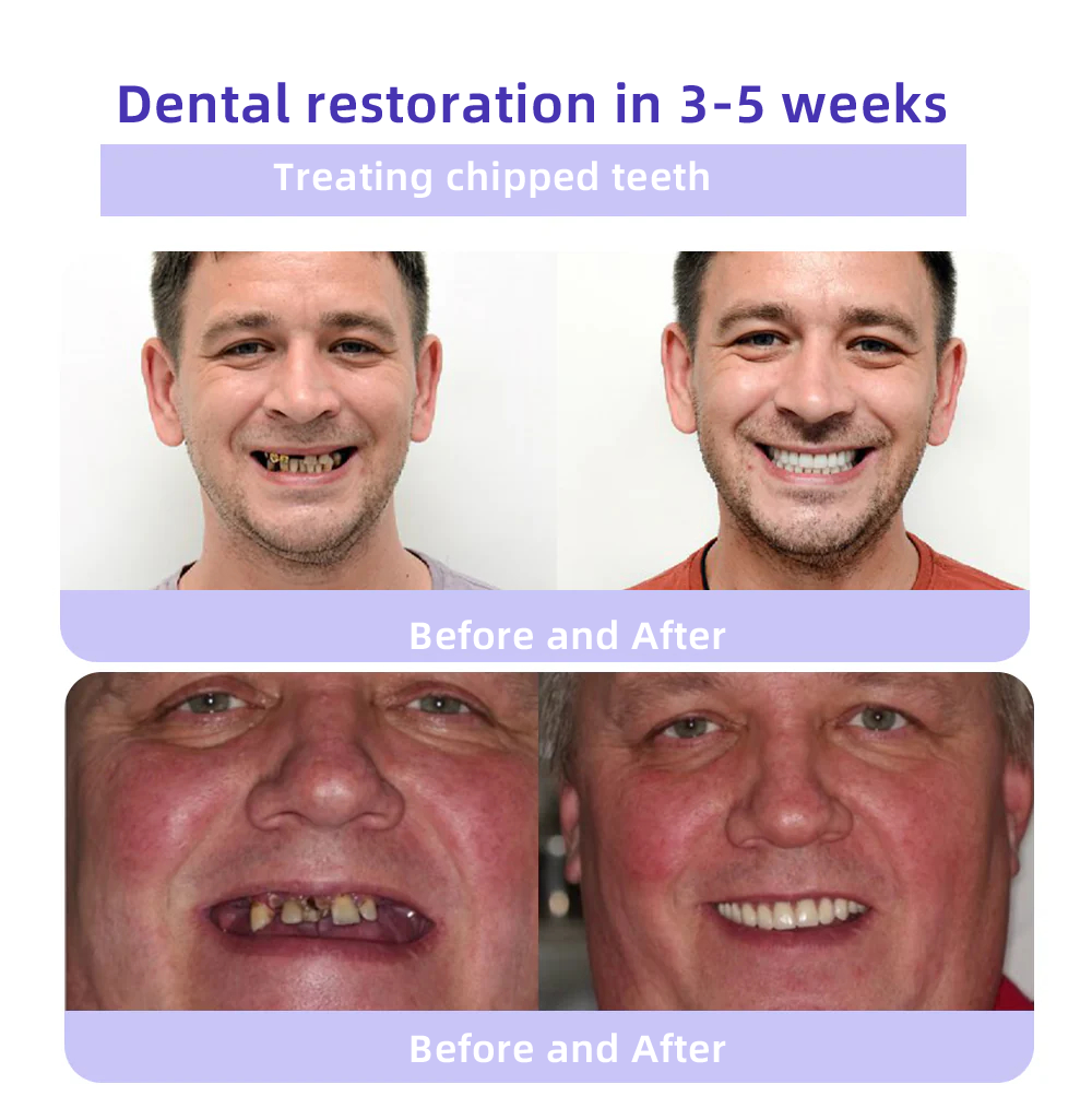 Oyikeyยฎ ๐Tooth Restoration Mineral Powder (Whitening, Restoring Tooth Health)