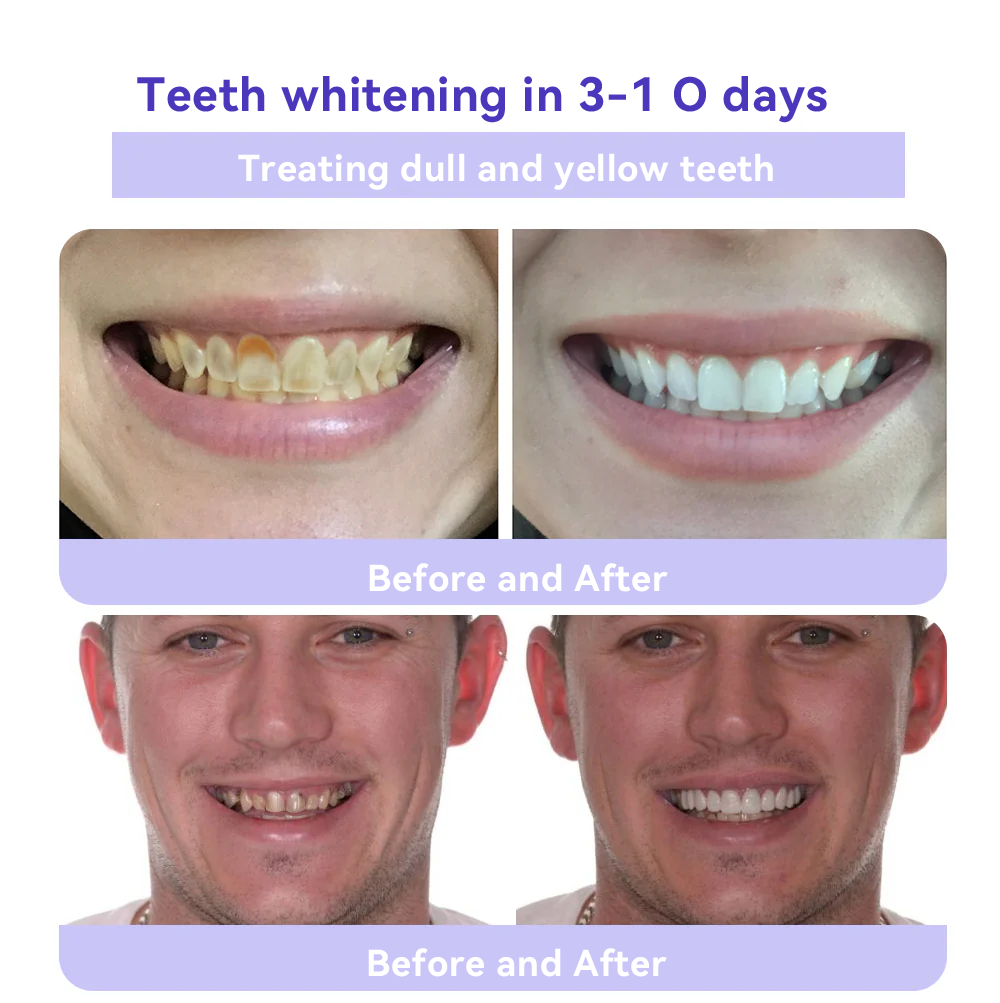Oyikeyยฎ ๐Tooth Restoration Mineral Powder (Whitening, Restoring Tooth Health)
