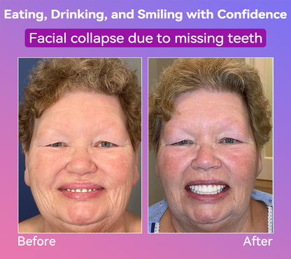 𝐉𝐚𝐬𝐬𝐞𝐞𝐦® Latest Premium Comfort Dentures🎁 (High-End Dentures, Easy to Wear - Limited Time 70% Discount)