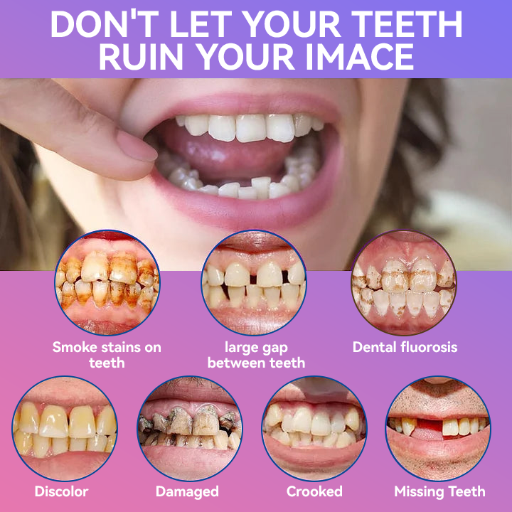 𝐉𝐚𝐬𝐬𝐞𝐞𝐦® Latest Premium Comfort Dentures💖 (High-End Dentures, Easy to Wear - Limited Time 70% Discount)🔥